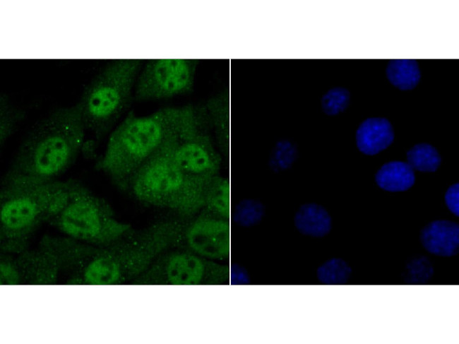 HDAC2 Antibody in Immunocytochemistry (ICC/IF)