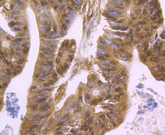 HDAC2 Antibody in Immunohistochemistry (Paraffin) (IHC (P))