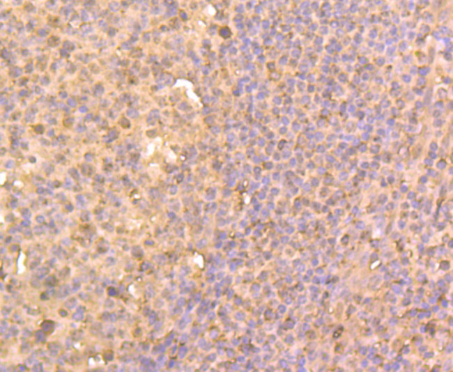 HDAC2 Antibody in Immunohistochemistry (Paraffin) (IHC (P))