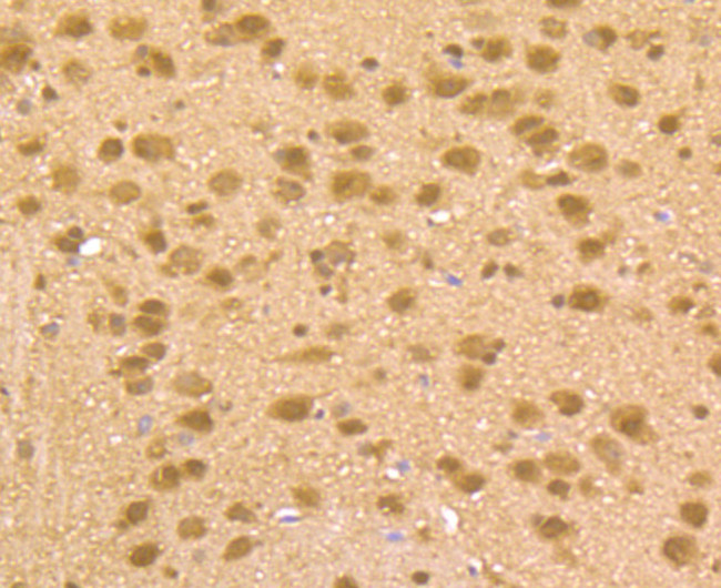 HDAC2 Antibody in Immunohistochemistry (Paraffin) (IHC (P))