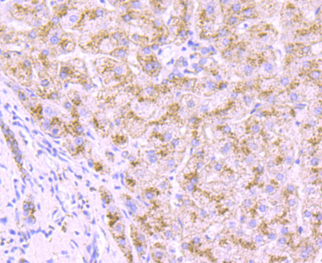 Cathepsin D Antibody in Immunohistochemistry (Paraffin) (IHC (P))