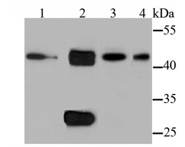 Cathepsin D Antibody in Western Blot (WB)