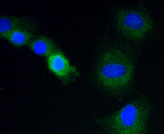 CYP2E1 Antibody in Immunocytochemistry (ICC/IF)