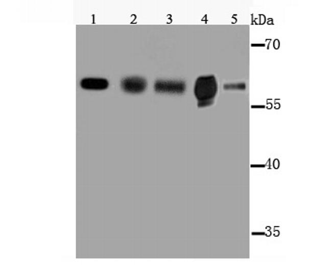 CYP2E1 Antibody in Western Blot (WB)