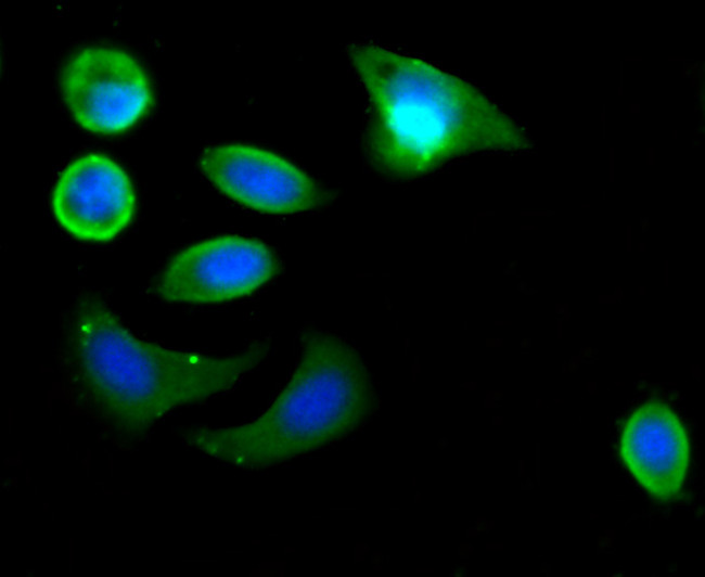 LYRIC Antibody in Immunocytochemistry (ICC/IF)