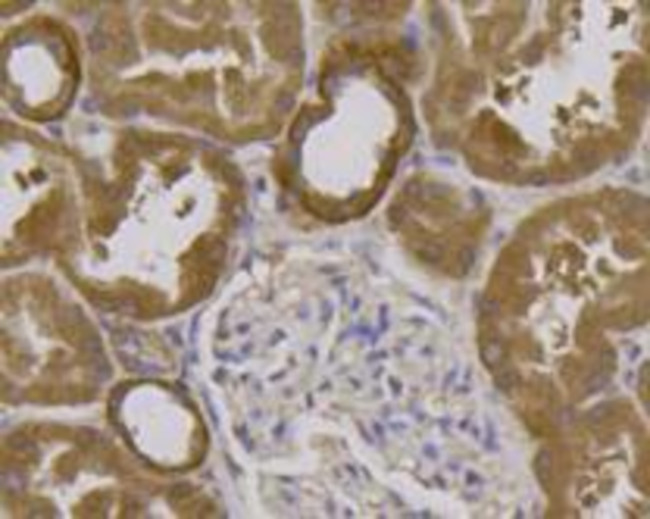 Beclin 1 Antibody in Immunohistochemistry (Paraffin) (IHC (P))