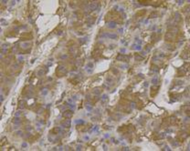 Beclin 1 Antibody in Immunohistochemistry (Paraffin) (IHC (P))