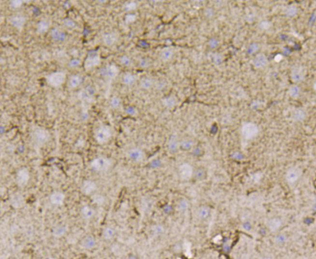 Beclin 1 Antibody in Immunohistochemistry (Paraffin) (IHC (P))