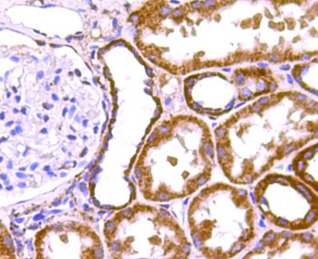 Prohibitin Antibody in Immunohistochemistry (Paraffin) (IHC (P))