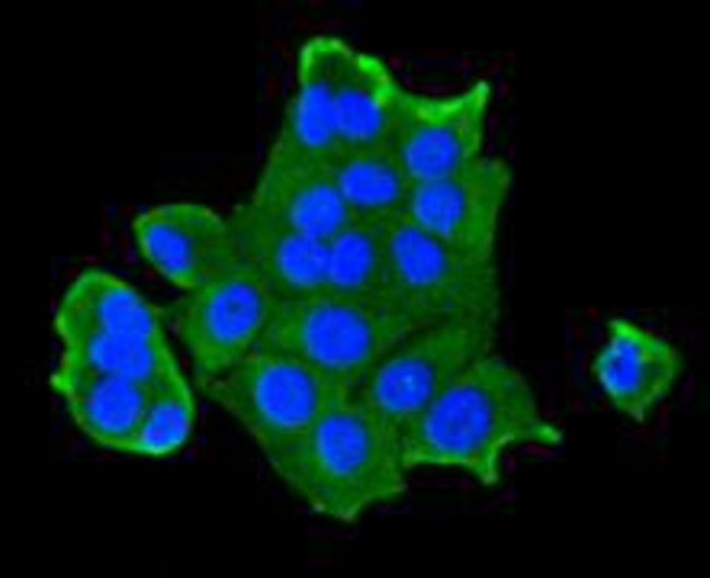 IGF2R Antibody in Immunocytochemistry (ICC/IF)