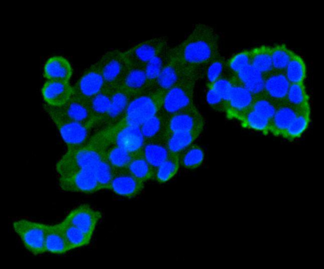 IGF2R Antibody in Immunocytochemistry (ICC/IF)