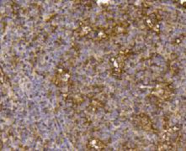 IGF2R Antibody in Immunohistochemistry (Paraffin) (IHC (P))