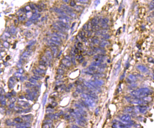 MCL-1 Antibody in Immunohistochemistry (Paraffin) (IHC (P))