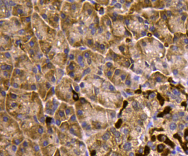 MCL-1 Antibody in Immunohistochemistry (Paraffin) (IHC (P))