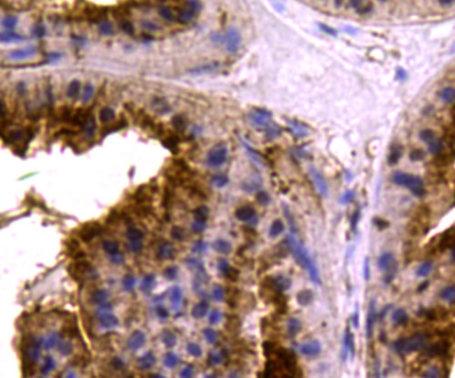 MCL-1 Antibody in Immunohistochemistry (Paraffin) (IHC (P))