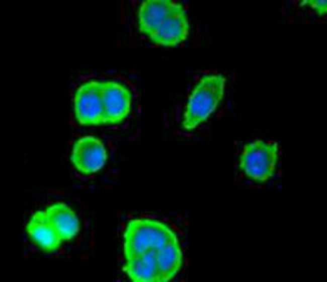 SMAD3 Antibody in Immunocytochemistry (ICC/IF)