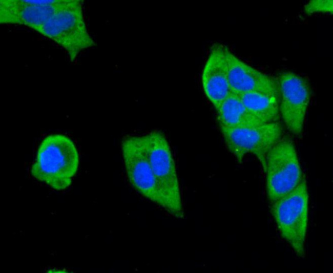 SMAD3 Antibody in Immunocytochemistry (ICC/IF)