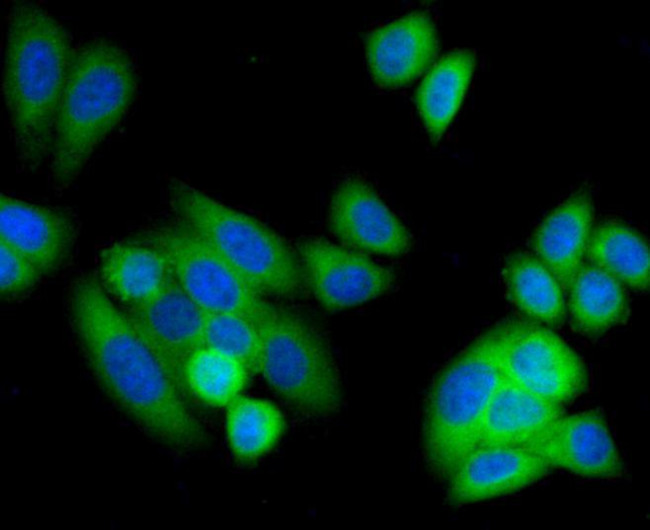 SMAD3 Antibody in Immunocytochemistry (ICC/IF)