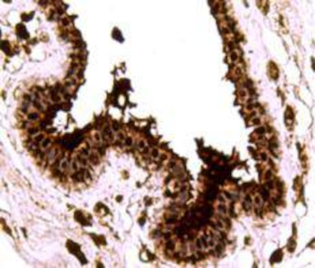 SMAD3 Antibody in Immunohistochemistry (Paraffin) (IHC (P))