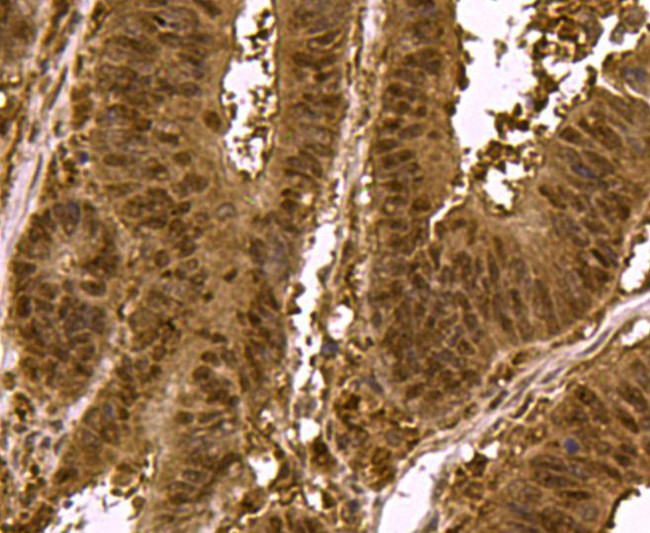 SMAD3 Antibody in Immunohistochemistry (Paraffin) (IHC (P))