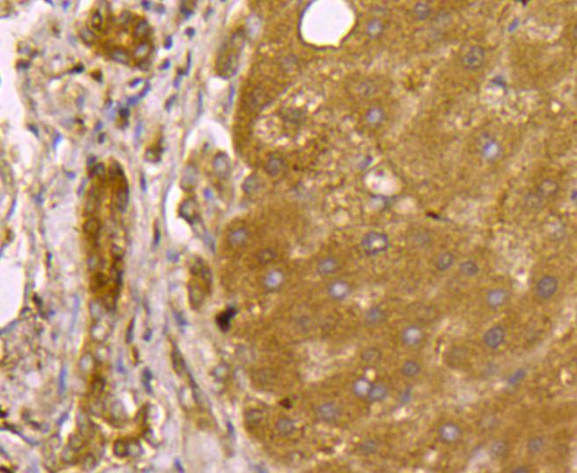 SMAD3 Antibody in Immunohistochemistry (Paraffin) (IHC (P))