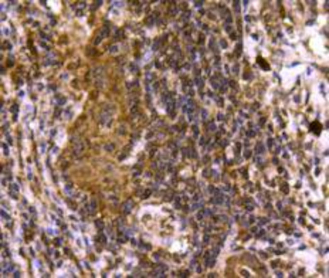 SMAD3 Antibody in Immunohistochemistry (Paraffin) (IHC (P))