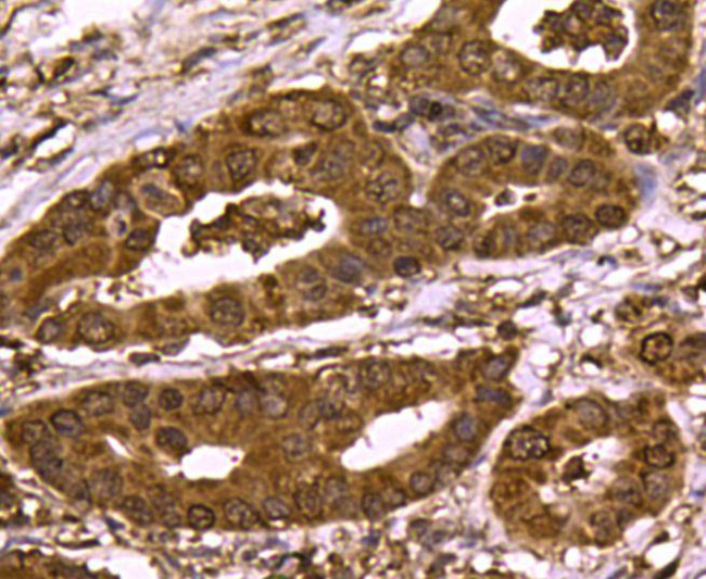 SMAD3 Antibody in Immunohistochemistry (Paraffin) (IHC (P))