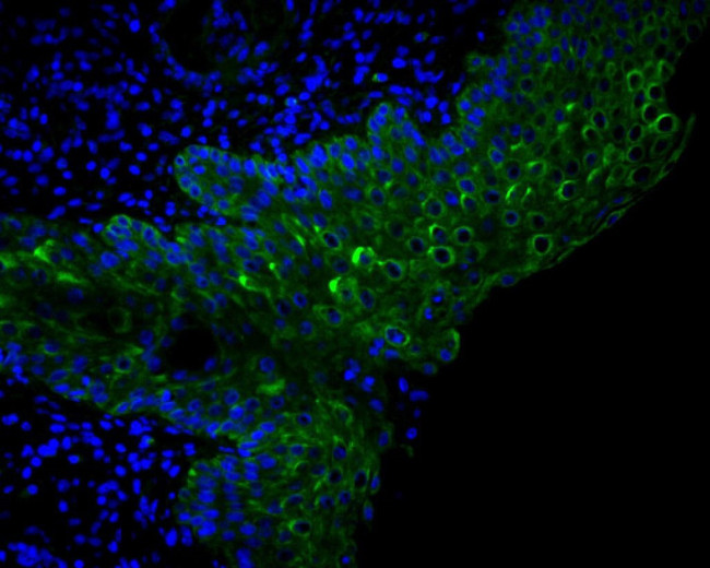 Beclin 1 Antibody in Immunohistochemistry (Paraffin) (IHC (P))