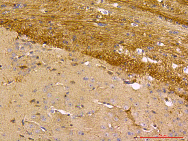 Beclin 1 Antibody in Immunohistochemistry (Paraffin) (IHC (P))