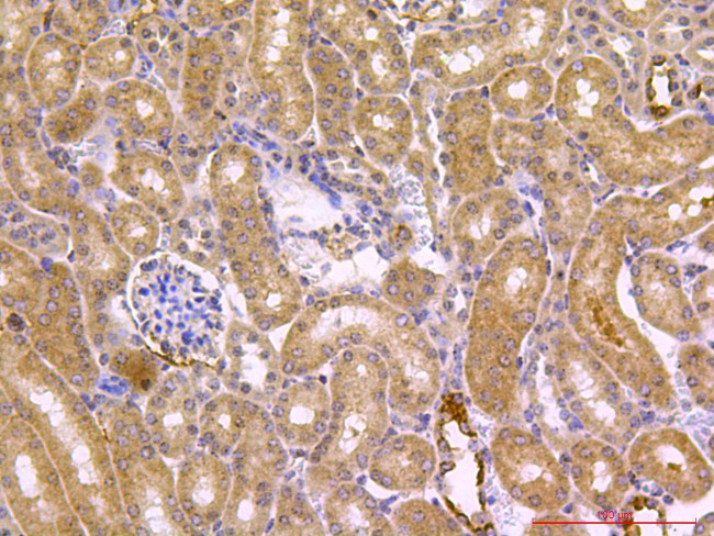 Beclin 1 Antibody in Immunohistochemistry (Paraffin) (IHC (P))