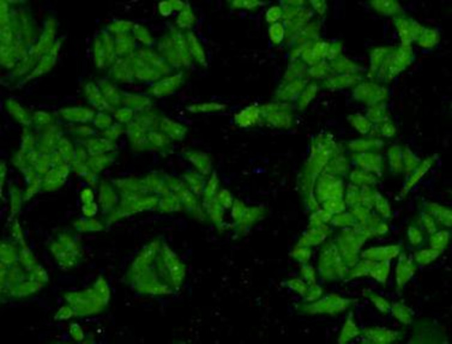 STAT1 Antibody in Immunocytochemistry (ICC/IF)