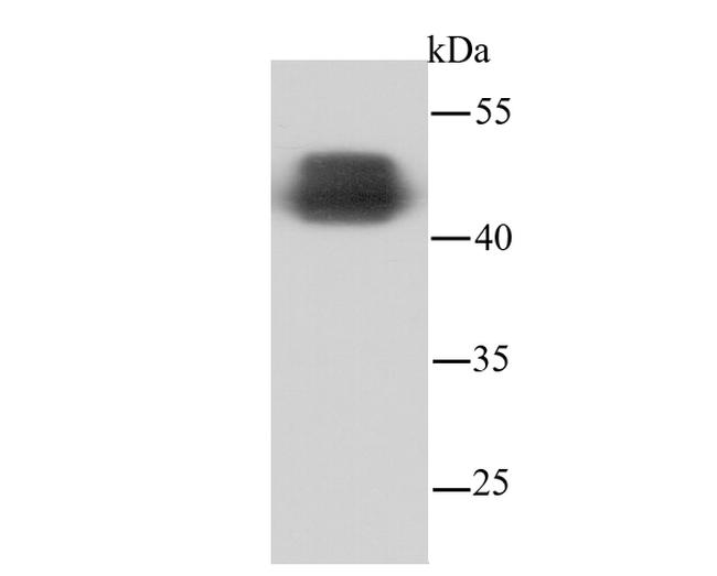 NSE Antibody in Western Blot (WB)