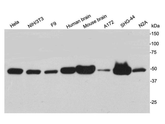 NSE Antibody in Western Blot (WB)