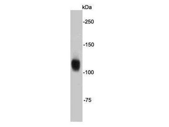 FGFR2 Antibody in Western Blot (WB)