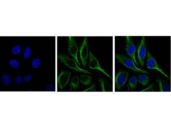 SQSTM1 Antibody in Immunocytochemistry (ICC/IF)