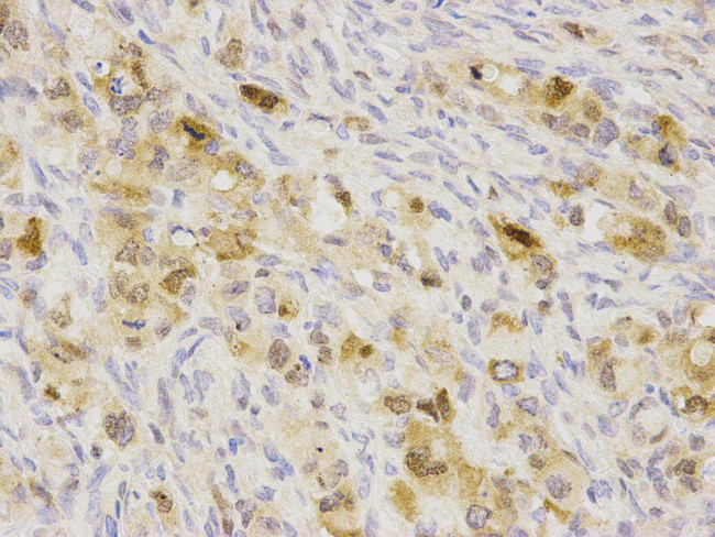 SQSTM1 Antibody in Immunohistochemistry (Paraffin) (IHC (P))