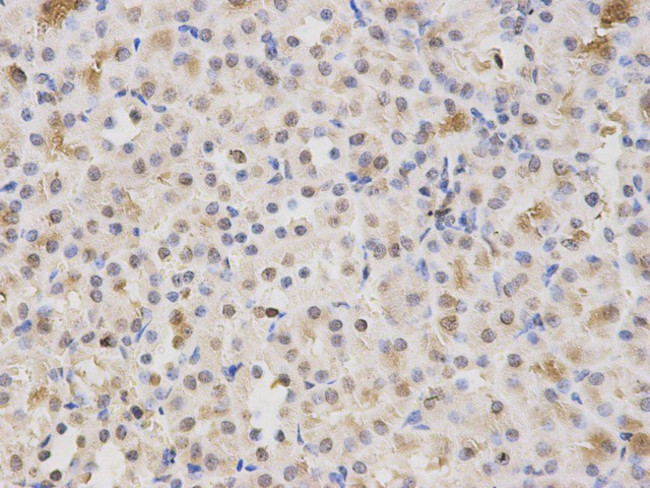 HMGB1 Antibody in Immunohistochemistry (Paraffin) (IHC (P))