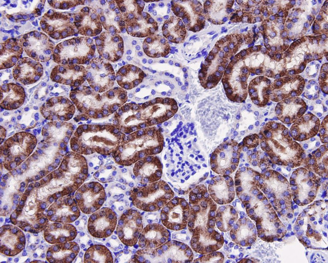 JNK1 Antibody in Immunohistochemistry (Paraffin) (IHC (P))