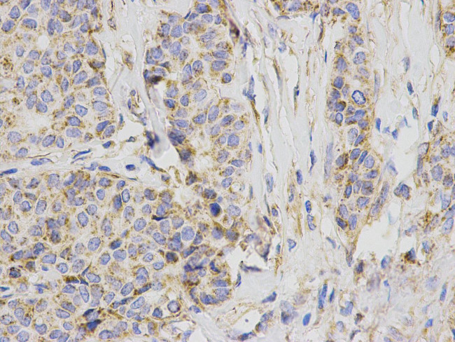 BCL-X Antibody in Immunohistochemistry (Paraffin) (IHC (P))