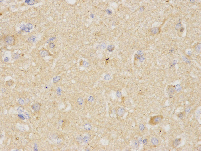 VDAC Antibody in Immunohistochemistry (Paraffin) (IHC (P))