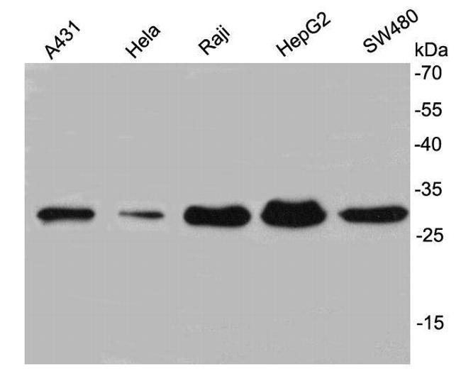 VDAC Antibody in Western Blot (WB)