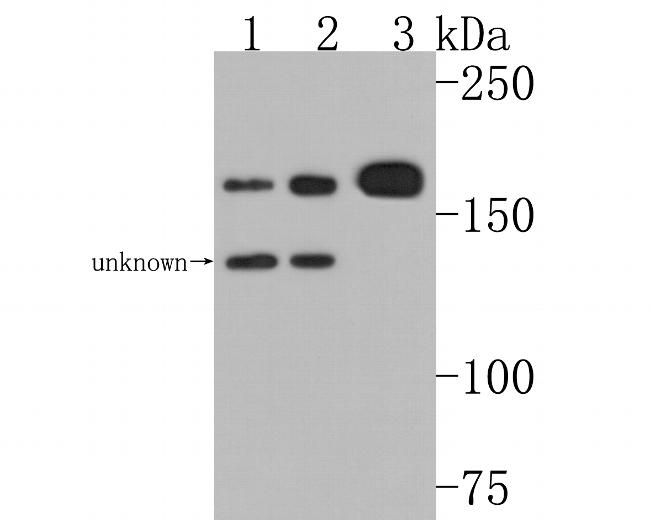 P-Glycoprotein Antibody in Western Blot (WB)