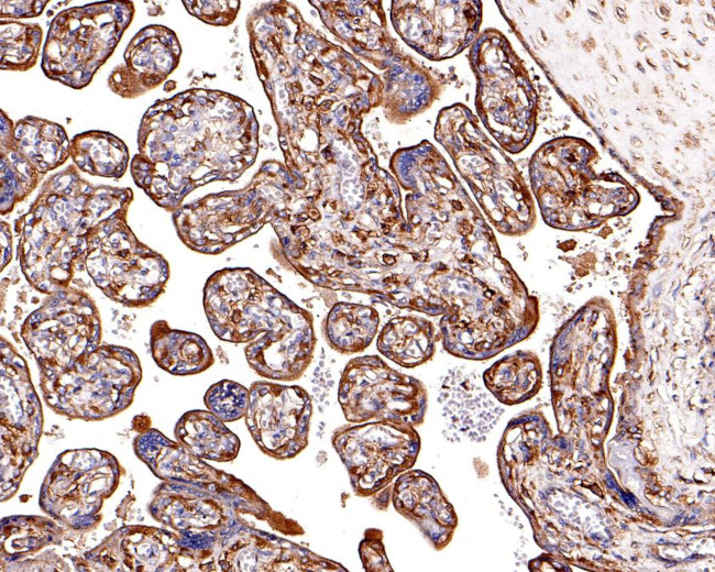 Clathrin Heavy Chain Antibody in Immunohistochemistry (Paraffin) (IHC (P))