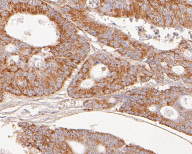 SLC15A1 Antibody in Immunohistochemistry (Paraffin) (IHC (P))