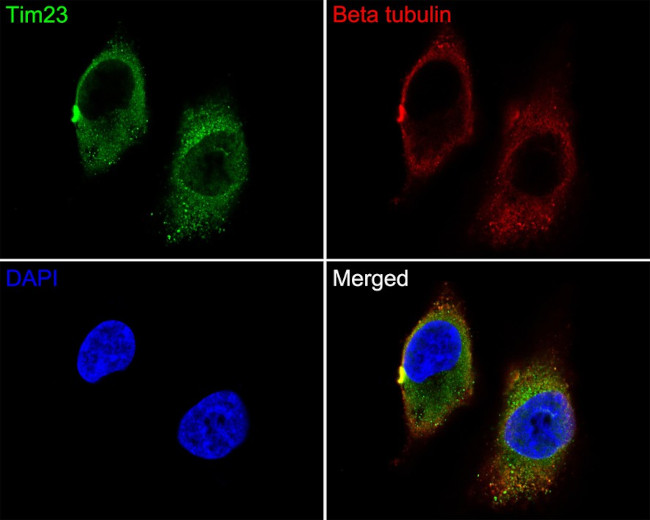 TIMM23 Antibody in Immunocytochemistry (ICC/IF)