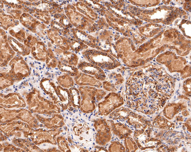 TIMM23 Antibody in Immunohistochemistry (Paraffin) (IHC (P))