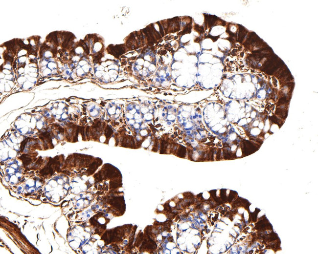 TIMM23 Antibody in Immunohistochemistry (Paraffin) (IHC (P))