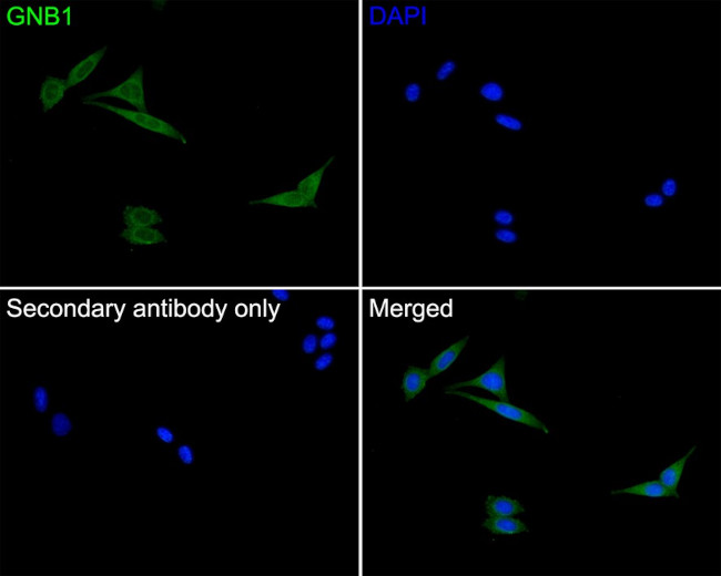 GNB1 Antibody in Immunocytochemistry (ICC/IF)