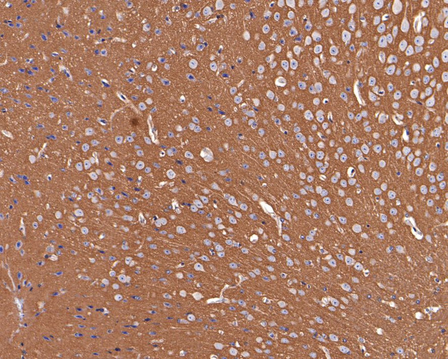 GNB1 Antibody in Immunohistochemistry (Paraffin) (IHC (P))