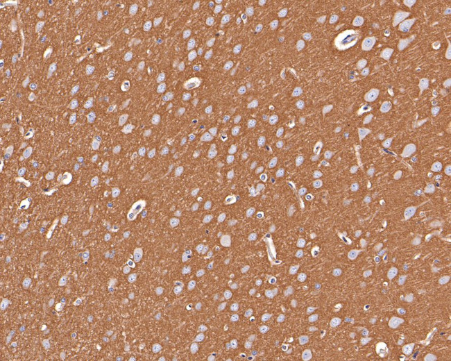 GNB1 Antibody in Immunohistochemistry (Paraffin) (IHC (P))